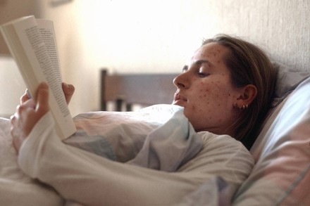 Morbillo, record di casi in Europa: 127.350 nel 2024